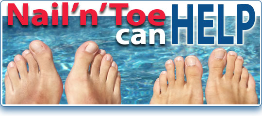 Nail'n'Toe laser treatment for toenail and fingernail fungus